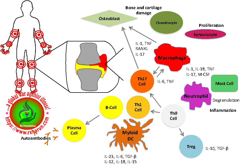 Rheumatoid-arthritis-Figure