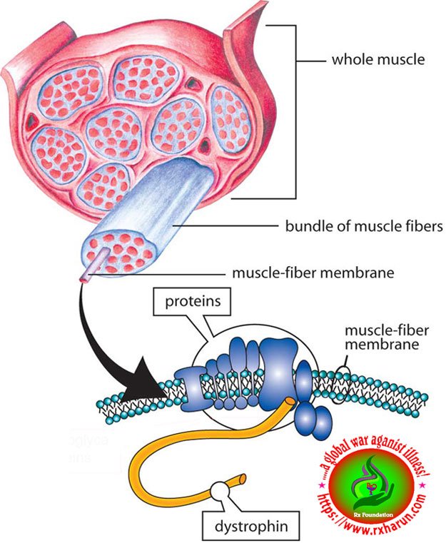 Duchenne Muscular Dystrophy