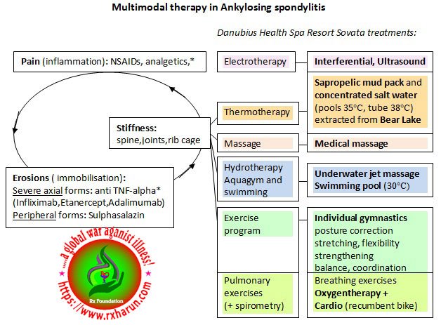 ankylosing spondilities