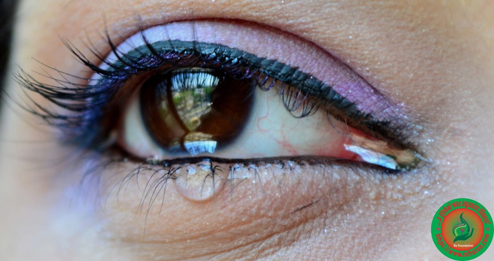 Pain