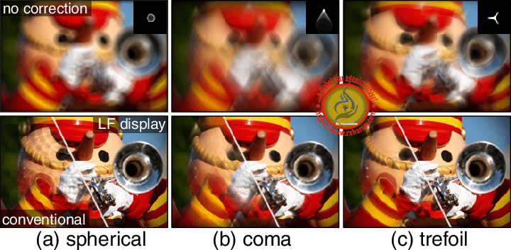 eye diseases Higher-Order Aberrations