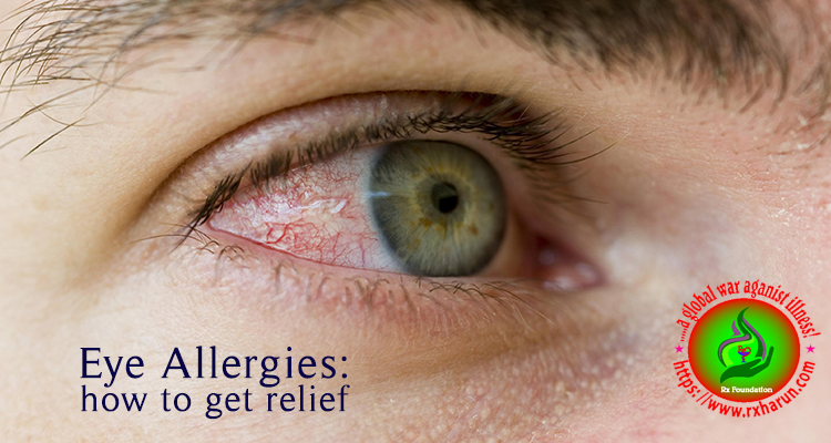 eye diseases Eye Allergies