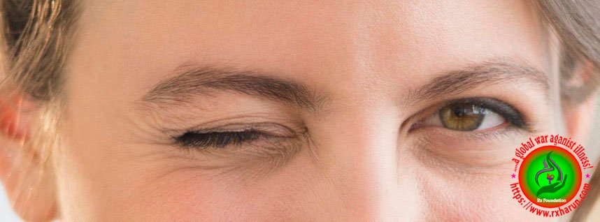eye-diseases-Eye Twitching
