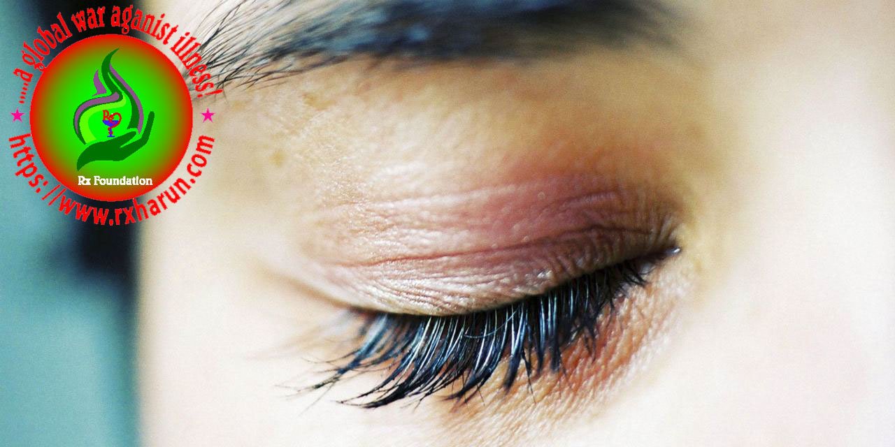 eye diseases Sleep in Your Eyes