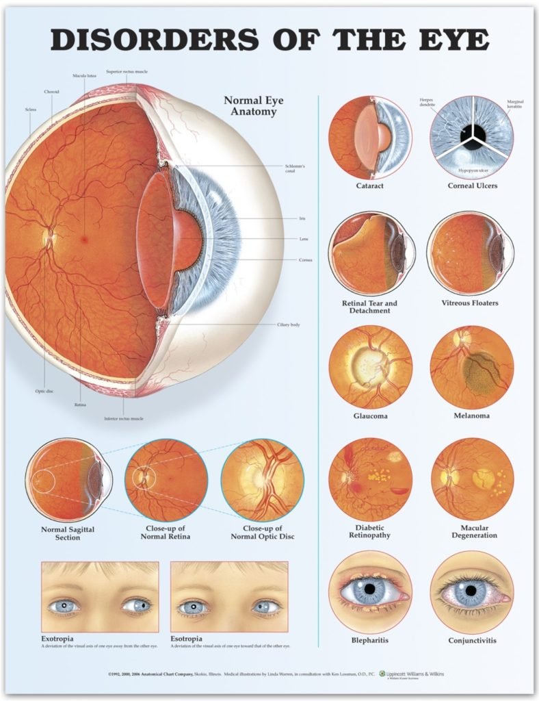 Nutritional Optic Neuropathy