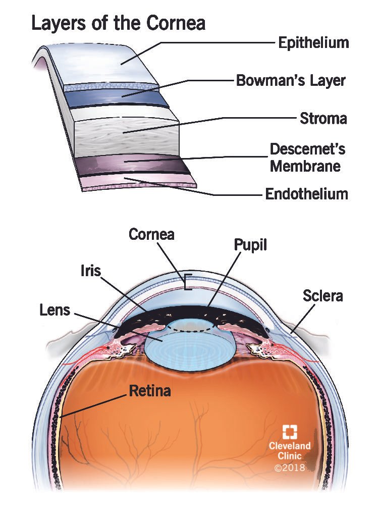 Corneal Grafting Indications