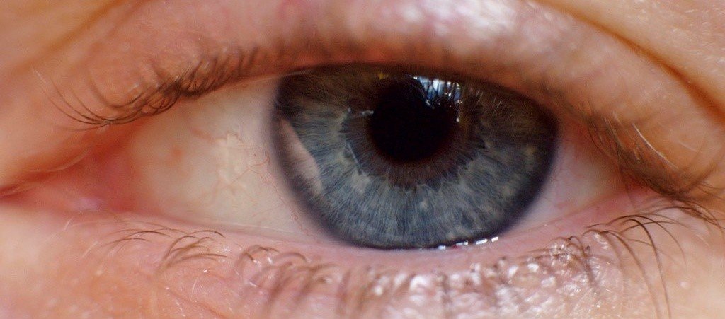 Blepharitis Treatment