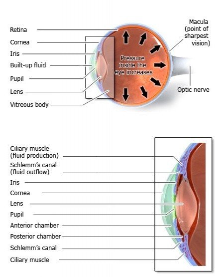 Glaucoma Surgery