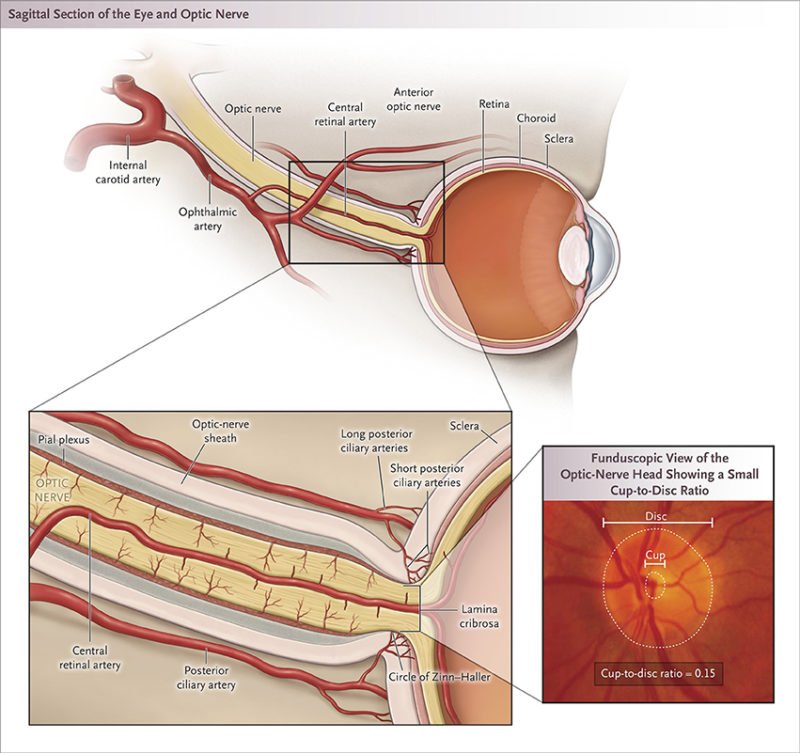 Nutritional Optic Neuropathy