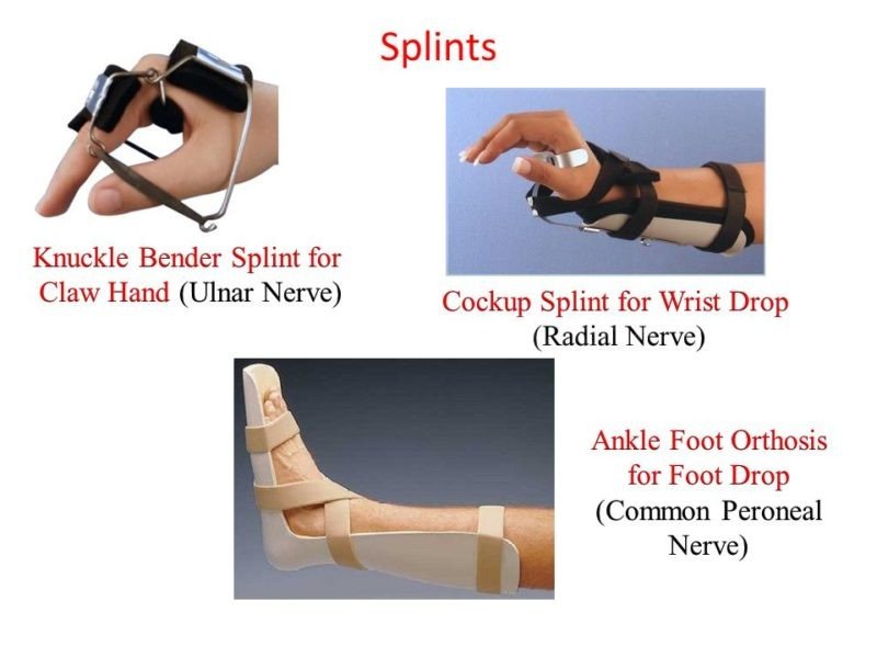 Knuckle Bender Splint Contraindications