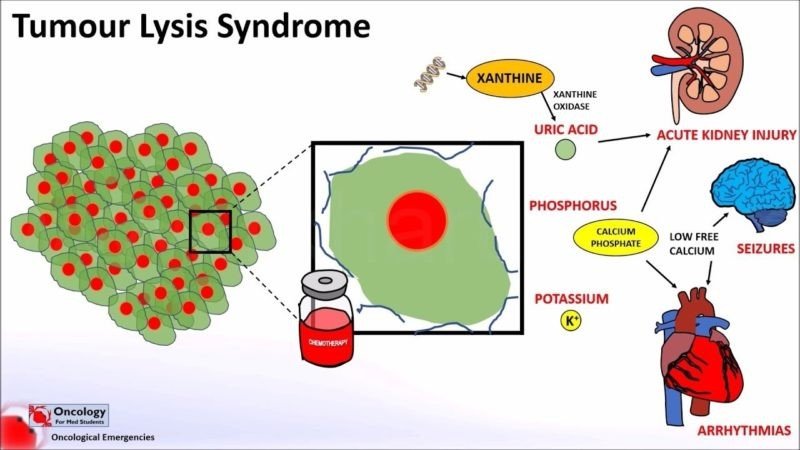 How is tumor lysis syndrome diagnosed?