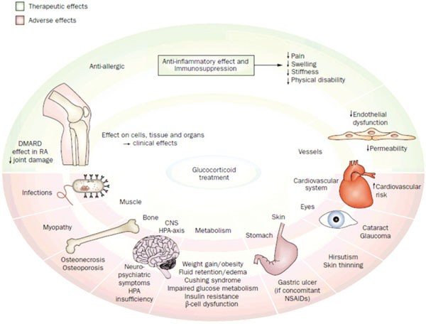 Glucocorticoid-Induced Osteoporosis
