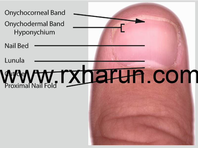 Test Diagnosis of Proximal Fingernails Infection
