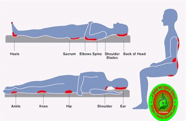 Test Diagnosis of Biceps Tear