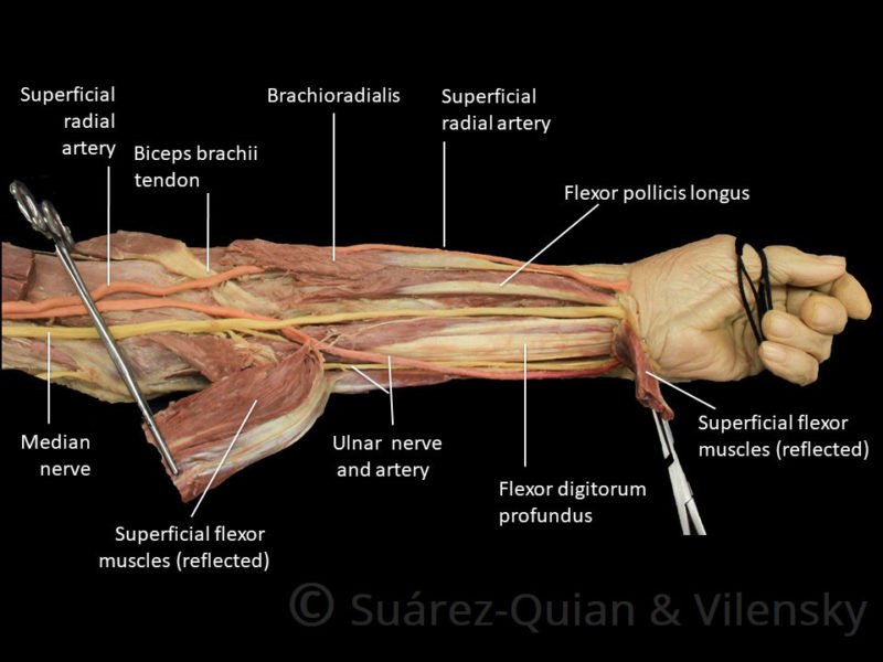 Stiff Elbow (Elbow Contracture)
