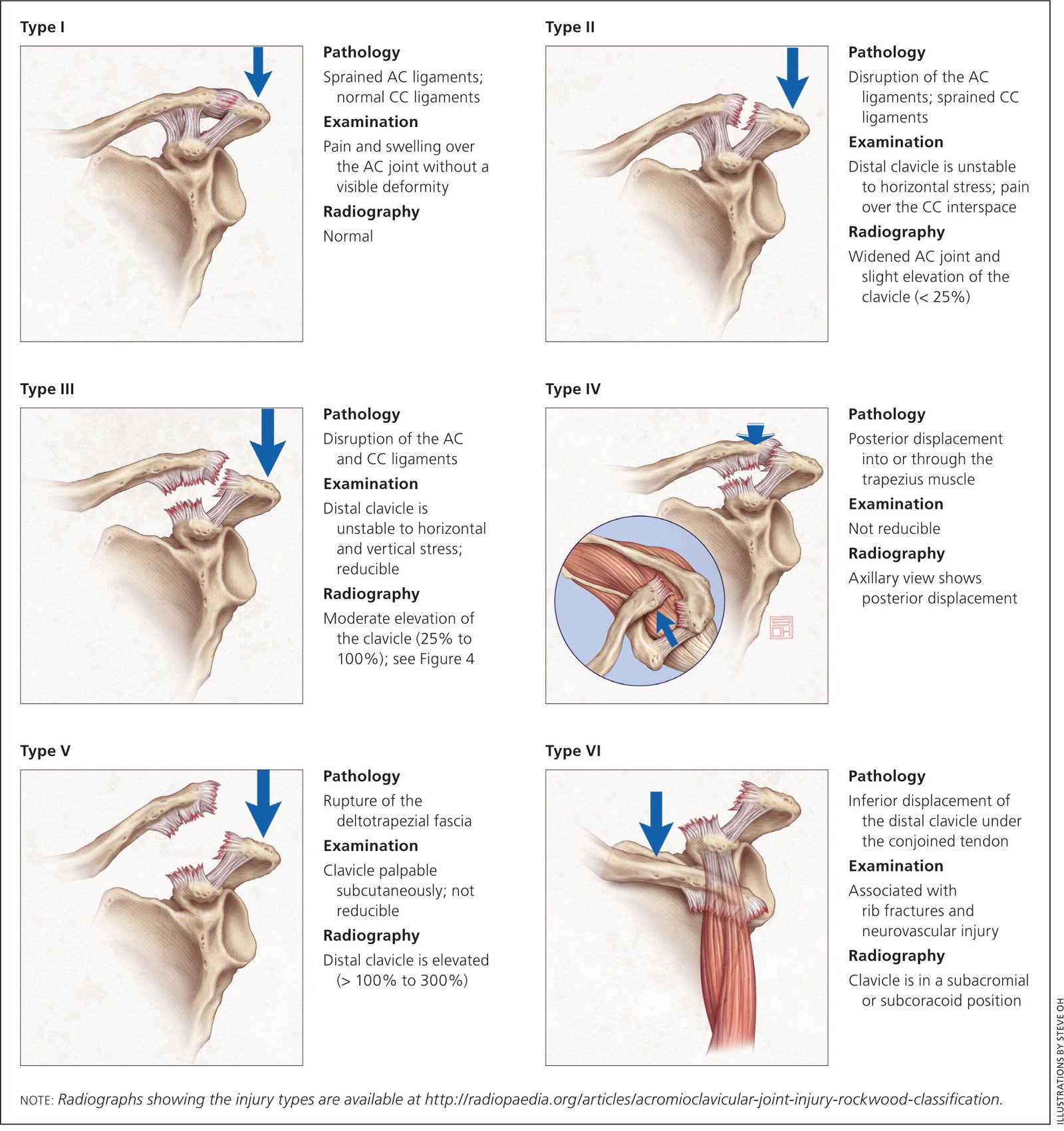 Movement of Shoulder Girdle