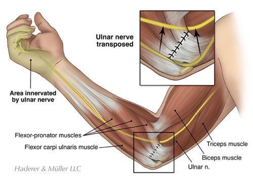 Elbow Joints Fractures