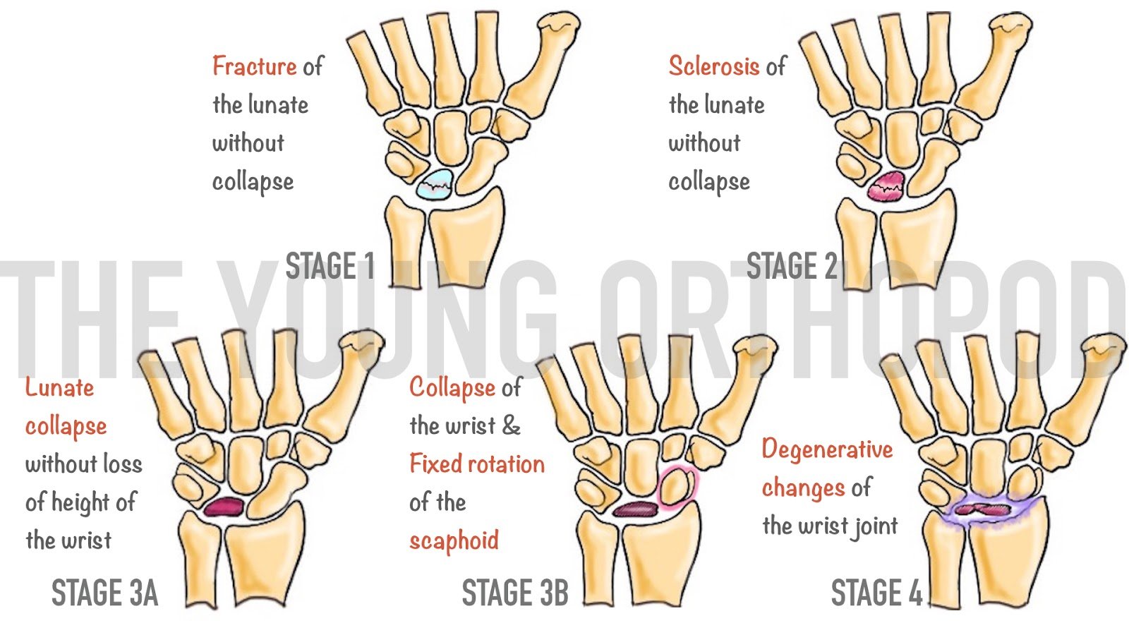 Wrist Joint