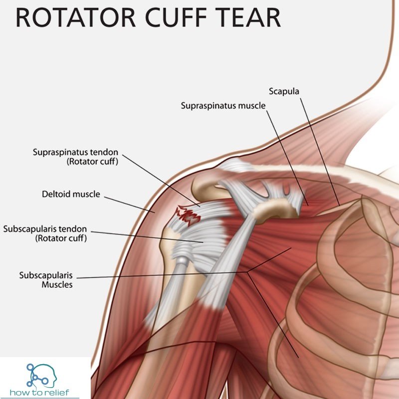 Blood Supply and Lymphatics of Rotator Cuff Muscle