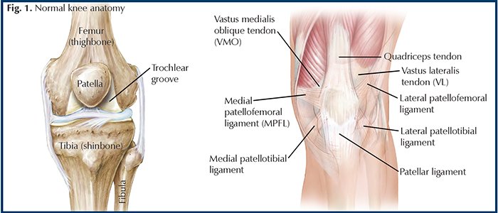 Knee Lateral Dislocation