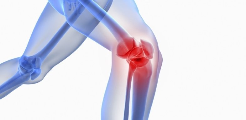 Causes of Knee Osteoarthritis