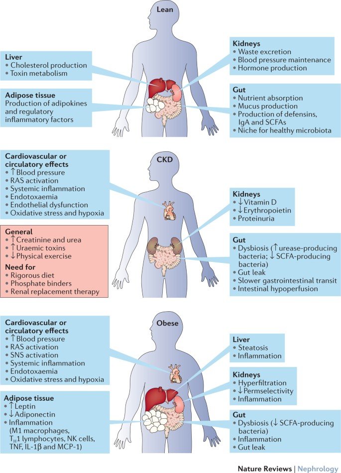 kidney transplant
