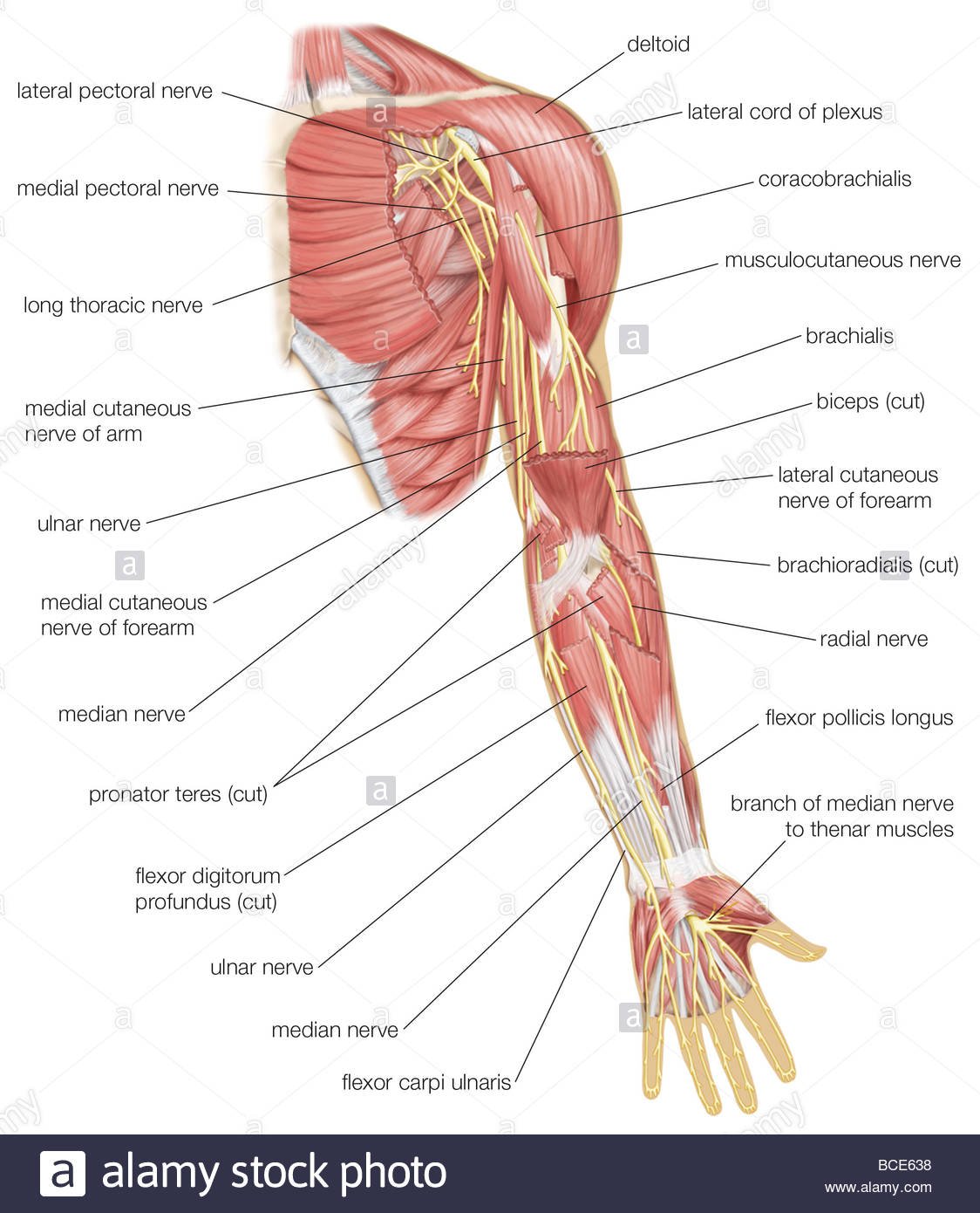 Median Nerve Palsy