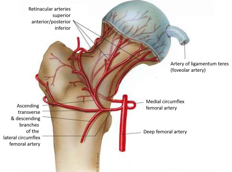 Avascular Necrosis (AVN)
