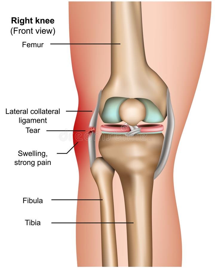Lateral Collateral Ligament Injury