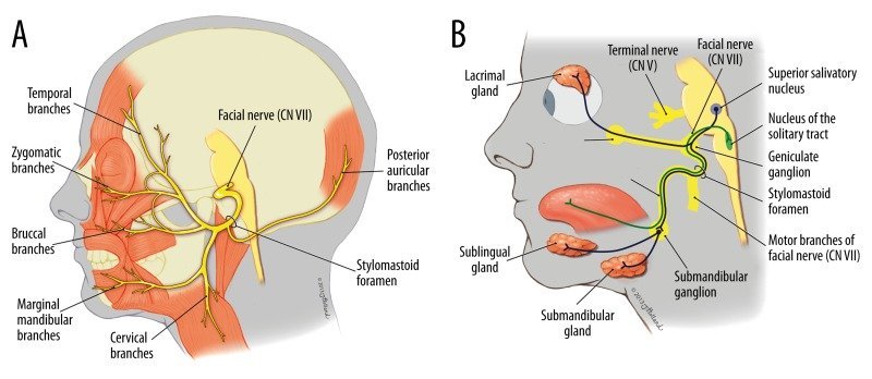 Distal Myopathy and Dysferlinopathy/Dysferlinopathy include a spectrum of muscle disease characterized by two main phenotypes: Miyoshi myopathy with primarily d